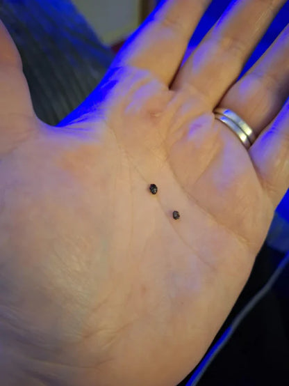 TagClear™ - Pain-free skin tag removal